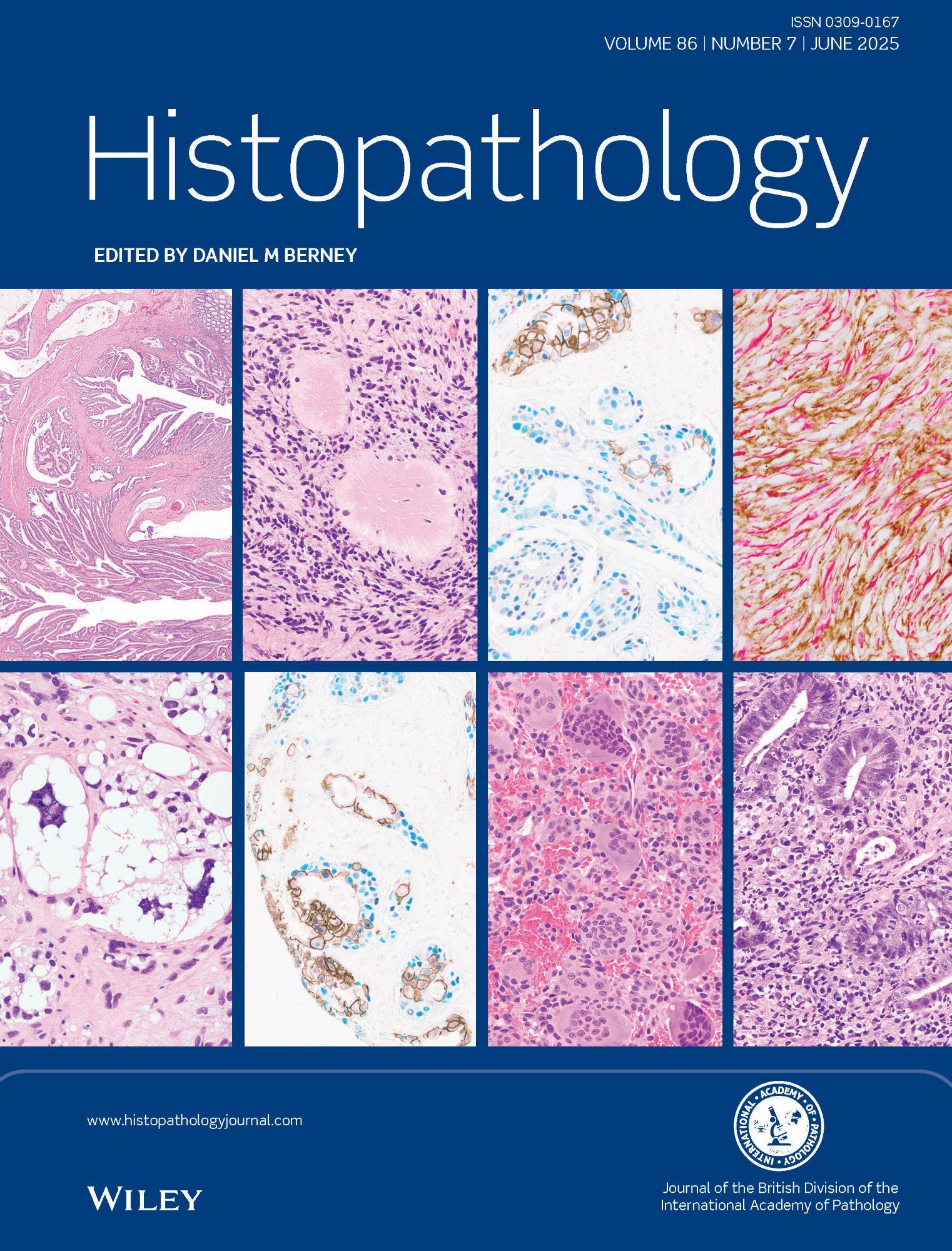 Histopathology Journal: Latest Issue Now Available image